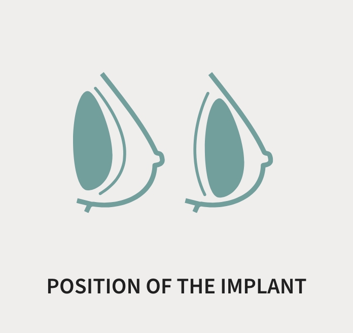Position of the Implant (graphic)