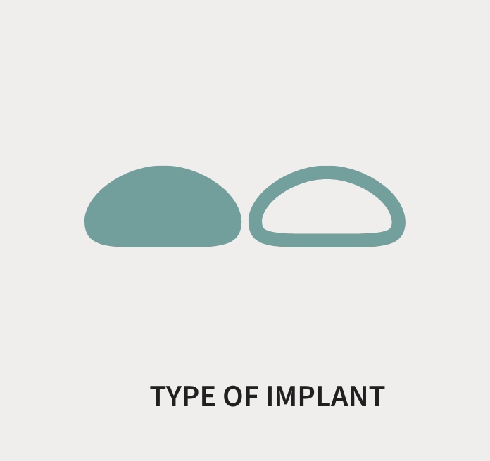 Type Of Implant (graphic)