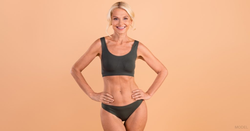 Woman after a body contouring procedure. (Model)